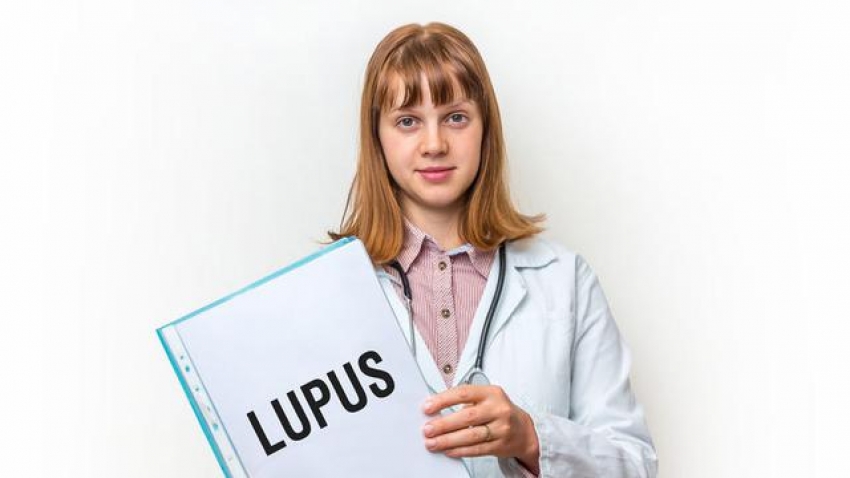 Gejala Penyakit Lupus dan Penyebabnya yang Kerap Menyerang Wanita